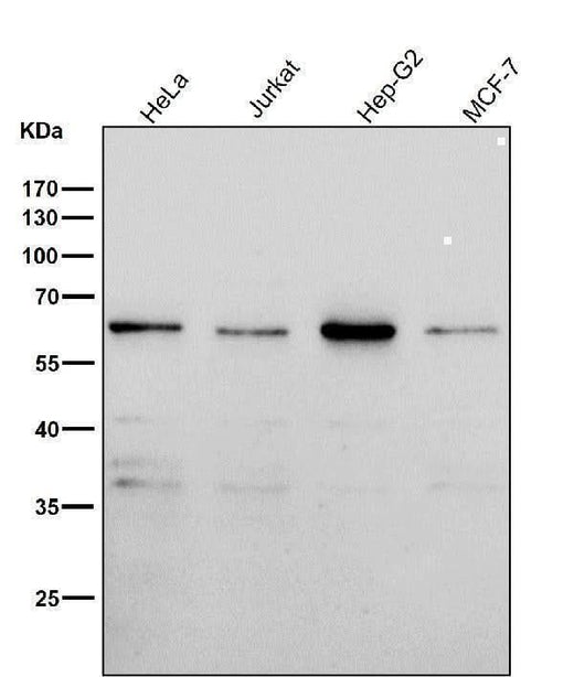Anti-PAX7 Rabbit Monoclonal Antibody Boster Bio