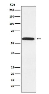 Anti-Lgi1 Rabbit Monoclonal Antibody Boster Bio
