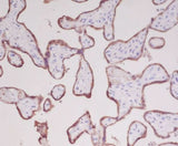 Anti-Growth Hormone GH1 Rabbit Monoclonal Antibody Boster Bio