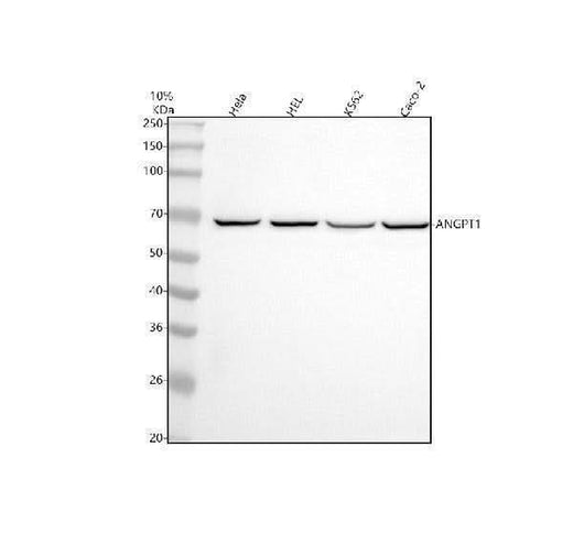 Anti-Angiopoietin 1 ANGPT1 Rabbit Monoclonal Antibody Boster Bio
