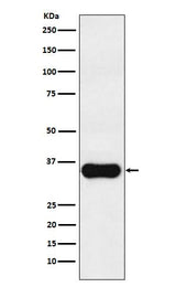 Anti-MC1 Receptor Rabbit Monoclonal Antibody Boster Bio