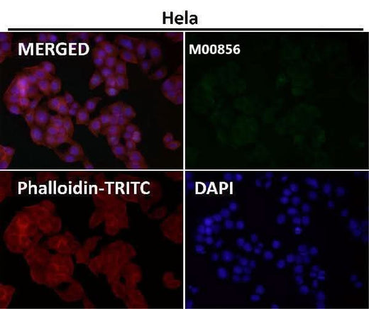 Anti-KAT13A / SRC1 Monoclonal Antibody Boster Bio