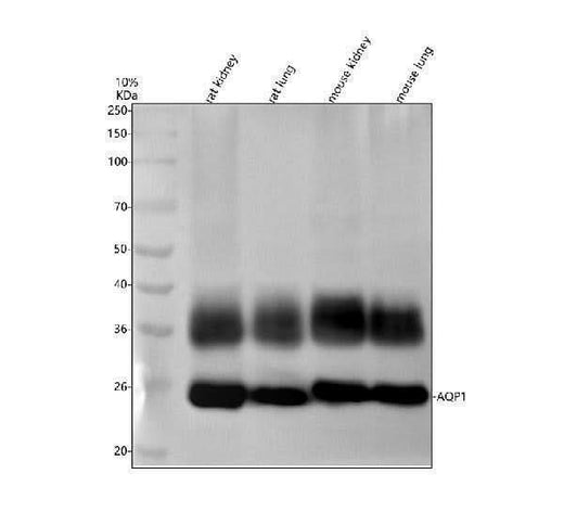 Anti-AQP1 Rabbit Monoclonal Antibody Boster Bio