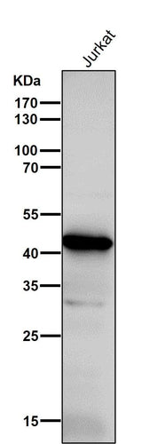 Anti-ADA Rabbit Monoclonal Antibody Boster Bio