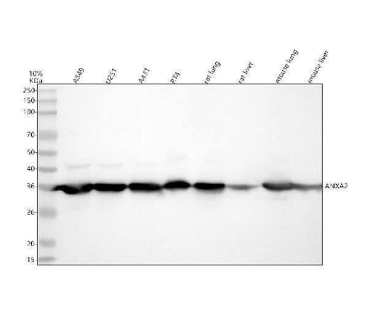 Anti-Annexin A2 ANXA2 Rabbit Monoclonal Antibody Boster Bio