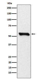 Anti-DLDH Rabbit Monoclonal Antibody Boster Bio