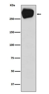 Anti-MRP1 ABCC1 Rabbit Monoclonal Antibody Boster Bio