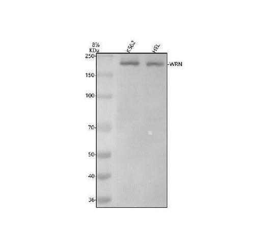 Anti-WRN Rabbit Monoclonal Antibody Boster Bio