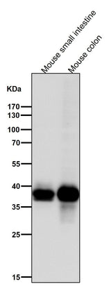 Anti-CDX2 Rabbit Monoclonal Antibody Boster Bio