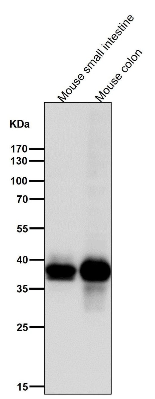 Anti-CDX2 Rabbit Monoclonal Antibody Boster Bio