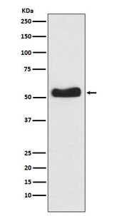 Anti-Glucokinase Rabbit Monoclonal Antibody Boster Bio