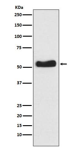 Anti-Glucokinase Rabbit Monoclonal Antibody Boster Bio