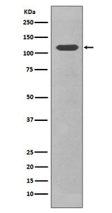 Anti-CD34 Rabbit Monoclonal Antibody Boster Bio