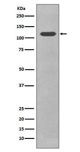 Anti-CD34 Rabbit Monoclonal Antibody Boster Bio