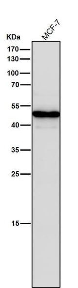 Anti-STF1 Rabbit Monoclonal Antibody Boster Bio