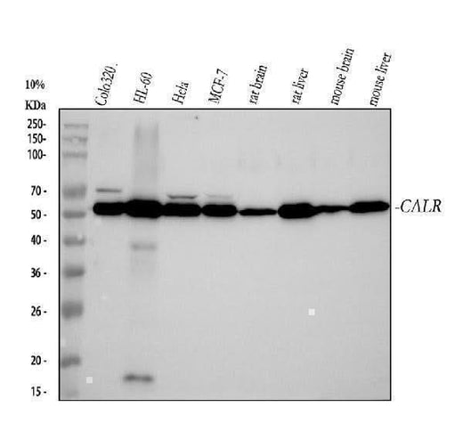 Anti-Calreticulin Rabbit Monoclonal Antibody Boster Bio