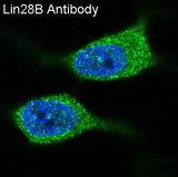 Anti-Lin28B Rabbit Monoclonal Antibody Boster Bio