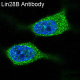 Anti-Lin28B Rabbit Monoclonal Antibody Boster Bio