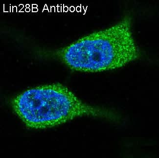 Anti-Lin28B Rabbit Monoclonal Antibody Boster Bio
