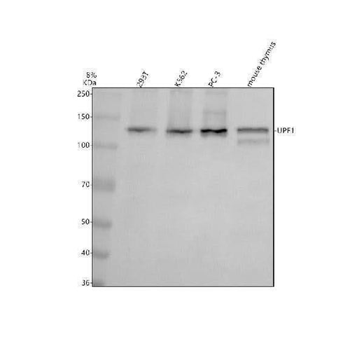 Anti-RENT1 / hUPF1 Rabbit Monoclonal Antibody Boster Bio