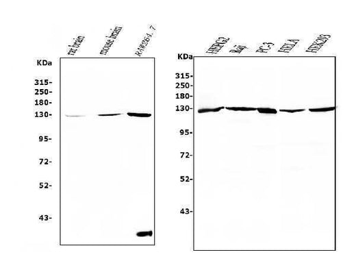 Anti-RENT1/hUPF1 Antibody Picoband® (monoclonal, 11E7 Boster Bio