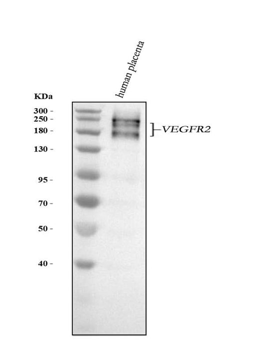 Anti-VEGF Receptor 2 KDR Rabbit Monoclonal Antibody Boster Bio