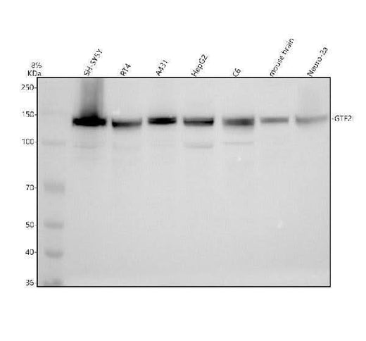 Anti-GTF2I Rabbit Monoclonal Antibody Boster Bio