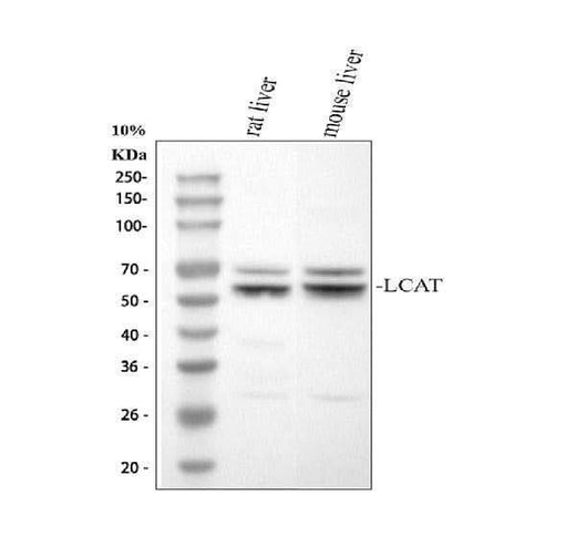 Anti-LCAT Rabbit Monoclonal Antibody Boster Bio