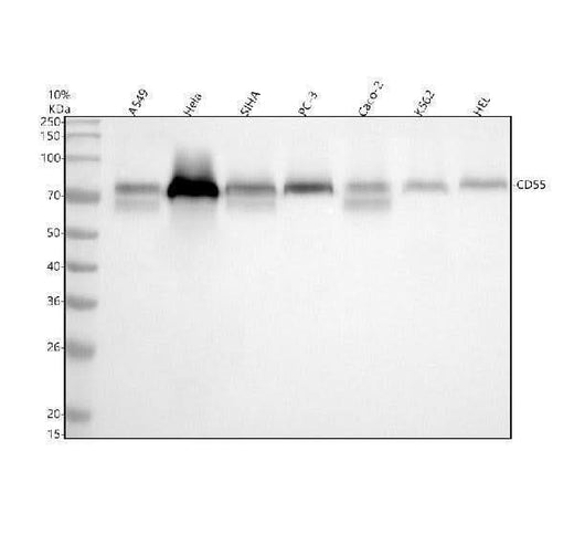 Anti-CD55 Rabbit Monoclonal Antibody Boster Bio