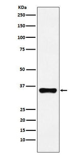 Anti-HOXA9 Rabbit Monoclonal Antibody Boster Bio