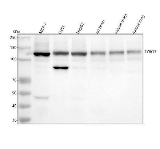 Anti-TYRO3 Rabbit Monoclonal Antibody Boster Bio
