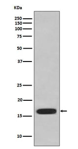Anti-CD59 Rabbit Monoclonal Antibody Boster Bio