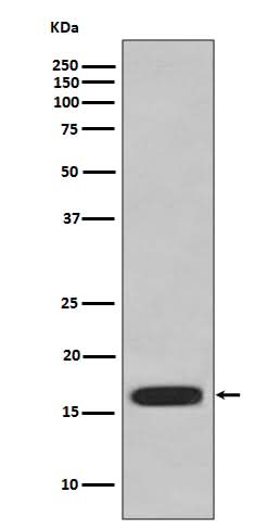 Anti-CD59 Rabbit Monoclonal Antibody Boster Bio