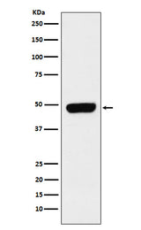 Anti-Pannexin 1 Rabbit Monoclonal Antibody Boster Bio