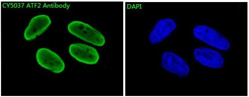 Anti-ATF2 Rabbit Monoclonal Antibody Boster Bio