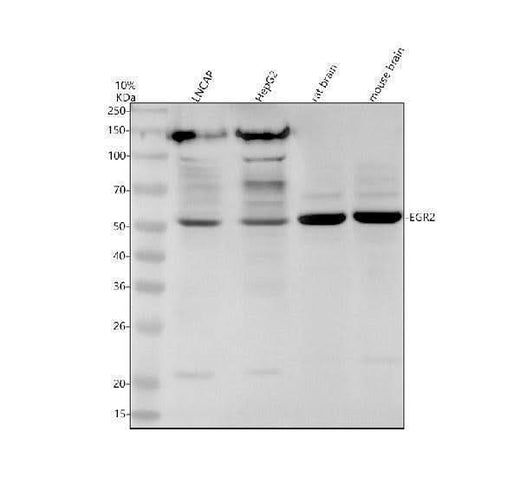 Anti-EGR2 Rabbit Monoclonal Antibody Boster Bio