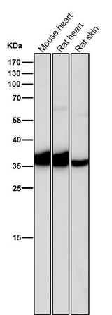 Anti-IGFBP1 Rabbit Monoclonal Antibody Boster Bio