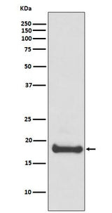 Anti-ARF6 Rabbit Monoclonal Antibody Boster Bio