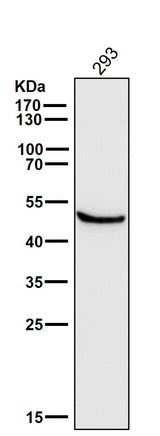 Anti-Glutathione Synthetase Rabbit Monoclonal Antibody Boster Bio