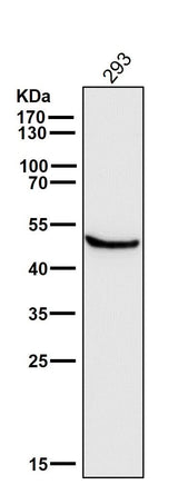 Anti-Glutathione Synthetase Rabbit Monoclonal Antibody Boster Bio