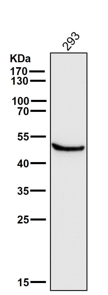 Anti-Glutathione Synthetase Rabbit Monoclonal Antibody Boster Bio