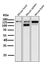 Anti-ASK1 MAP3K5 Rabbit Monoclonal Antibody Boster Bio