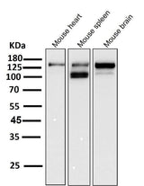 Anti-ASK1 MAP3K5 Rabbit Monoclonal Antibody Boster Bio