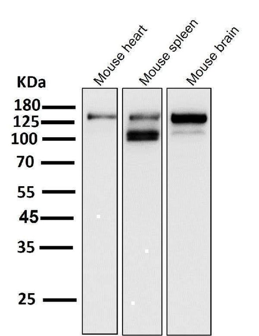 Anti-ASK1 MAP3K5 Rabbit Monoclonal Antibody Boster Bio
