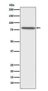 Anti-PSAP Rabbit Monoclonal Antibody Boster Bio