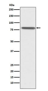 Anti-PSAP Rabbit Monoclonal Antibody Boster Bio