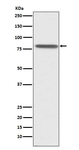 Anti-PSAP Rabbit Monoclonal Antibody Boster Bio