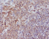 Anti-SHP1 PTPN6 Rabbit Monoclonal Antibody Boster Bio