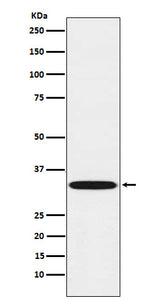 Anti-TREX1 Rabbit Monoclonal Antibody Boster Bio