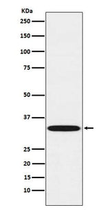 Anti-TREX1 Rabbit Monoclonal Antibody Boster Bio